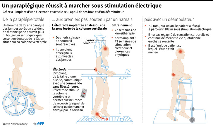 paraplegique-reussit-marcherstimulation-electrique_0_728_433